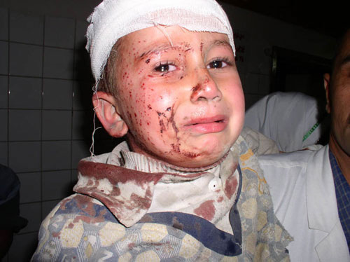 Wounded Iraqi Child - Click Photo for Video